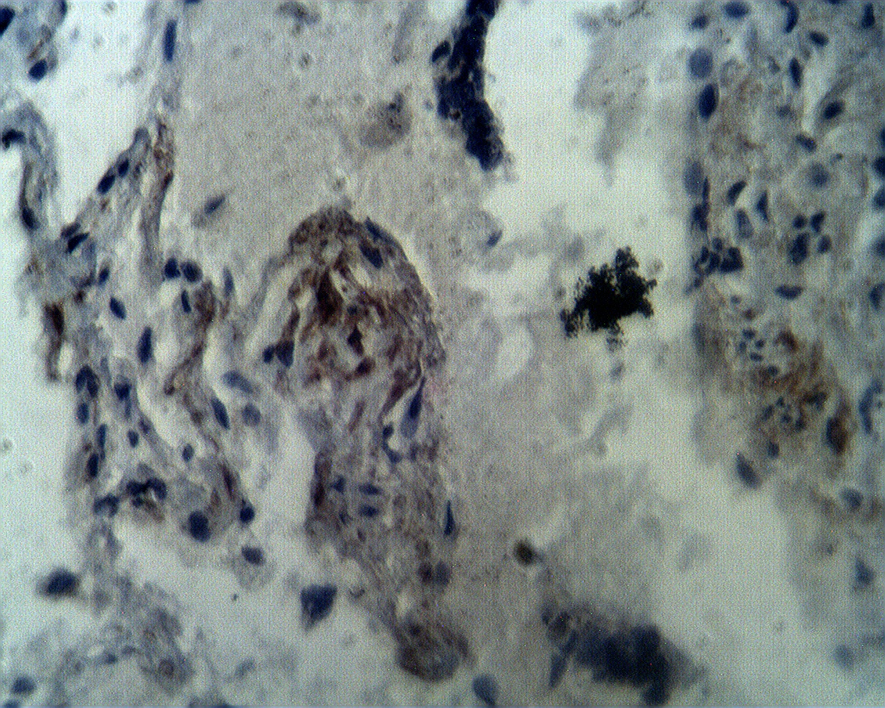 Immunohistochemical staining of normal human lung tissue using Aprataxin antibody (Cat. No. X2725P) at 10 µg/ml.